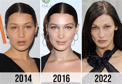 bella hadid before diet.